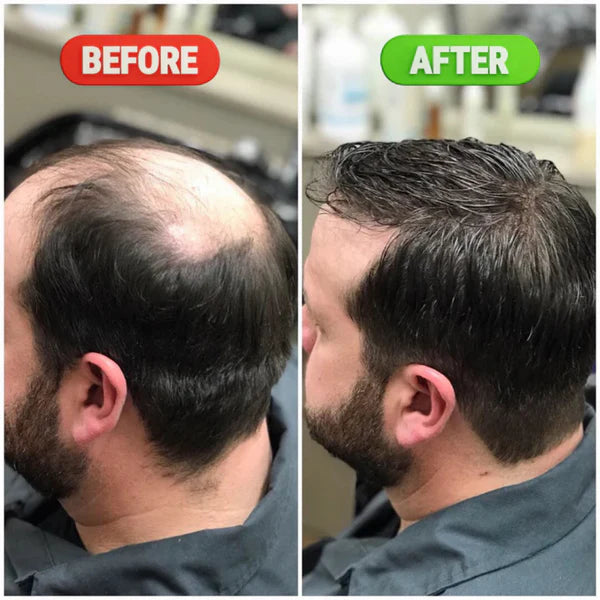 Rosemary & Rice Water Hair Growth Spray - 200ml